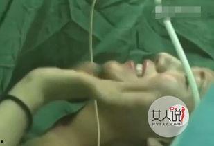 隆胸手术网红直播,隆胸手术全过程与术后护理